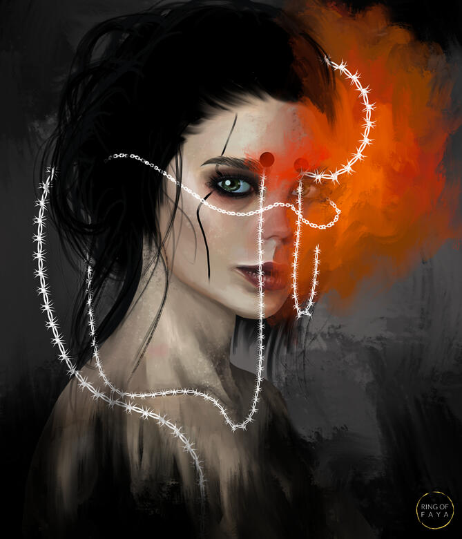 Migraine